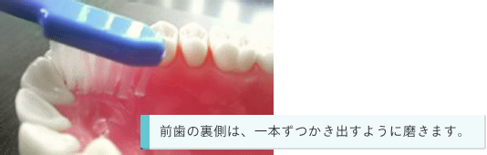 前歯の裏側は、一本ずつかき出すように磨きます。
